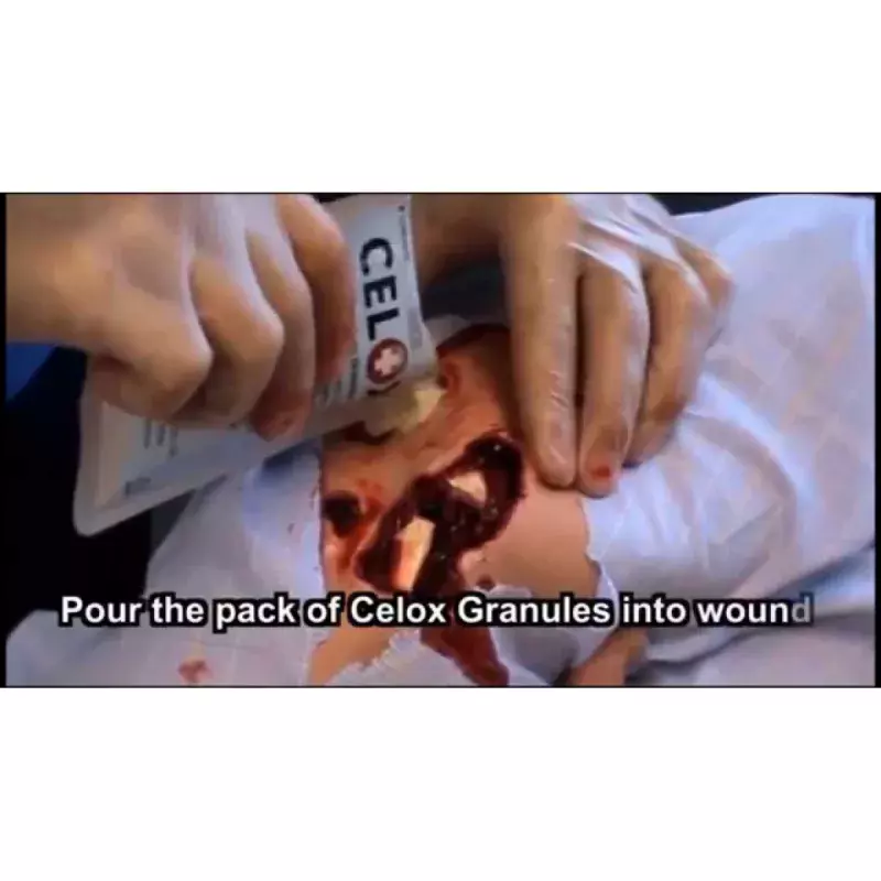 Granules Hémostatiques 35g - Celox